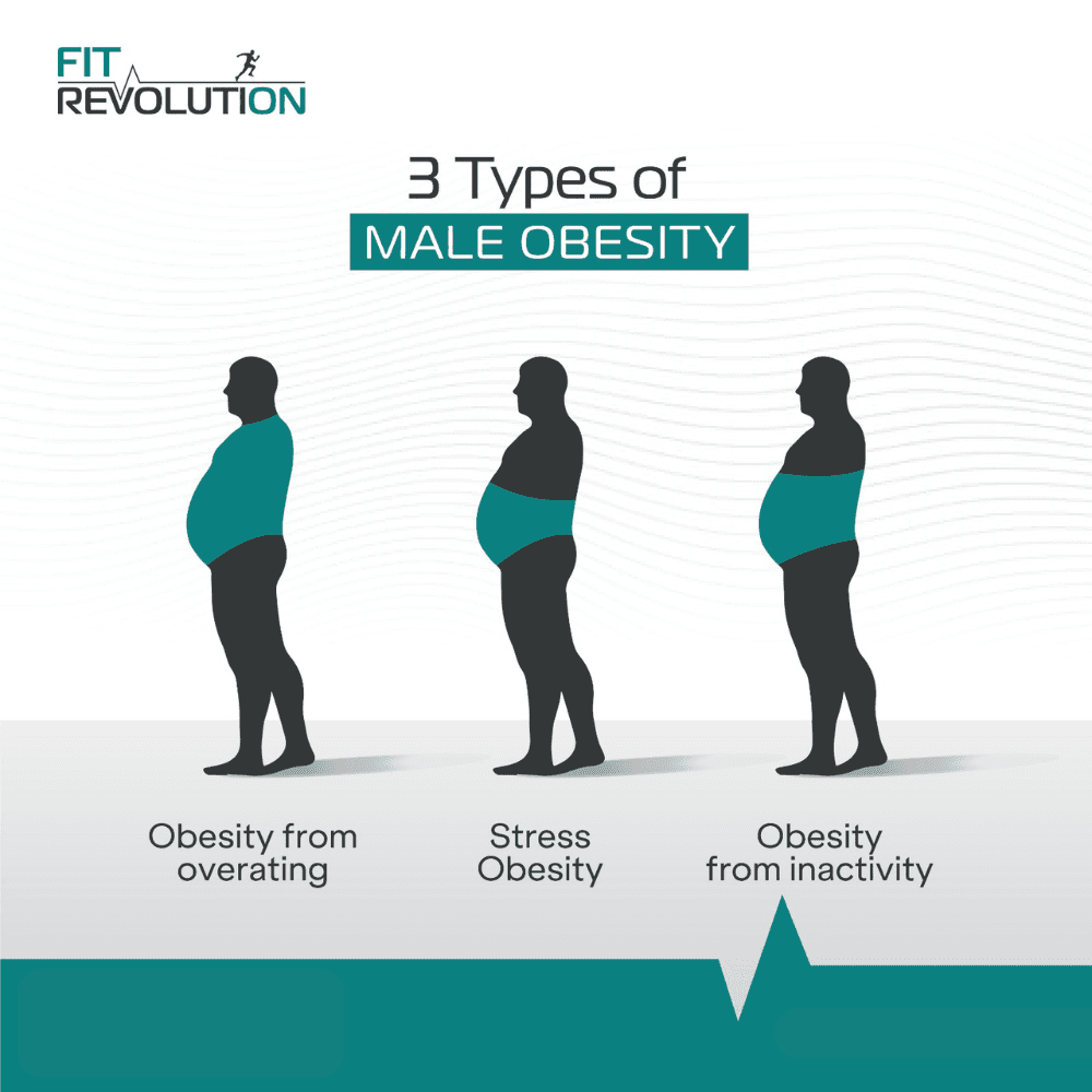 3 Types of Male Obesity